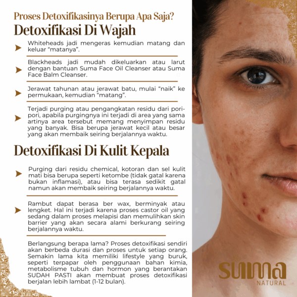 Suma Natural Multipurpose Soap - Sabun Alami & Multifungsi | Sabun Jerawat Punggung, Eczema, Eksim, Psoriasis & Sensitif, No SLS/SLES, No Detergent, No Paraben, No Triclosan, No Synthetic, No Foaming Agents. Body Wash Tubuh Gatal Mandi Berminyak Berjerawat - Image 8